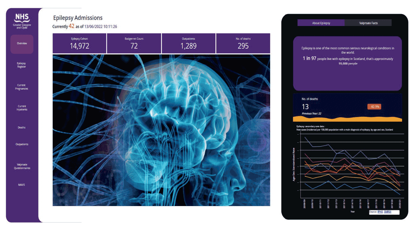 Showing two images together, representing screen shots from the NHS Greater Glasgow & Clyde Scottish Epilepsy Register ‘Overview’ tab on the Dashboard function. The first image on the left shows a computerised screenshot of a page titled ‘Epilepsy Admissions’ along with various navigation options along with a x-ray like image of a human head. The image on the right shows a mobile phone screenshot with navigation options and an image of a graph with fluctuating lines.