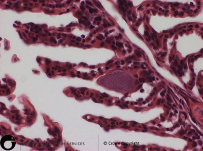 Branchial cysts (epitheliocystis) at the base of the secondary lamellae surrounded a thickened host epithelium. H&E staining