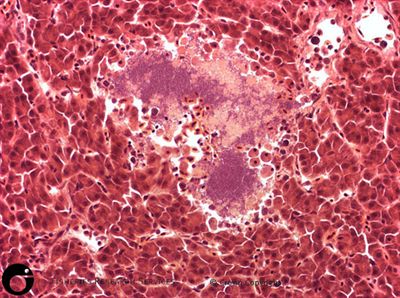 Focal_diffusing hepatic necrosis, x40, H&E stain