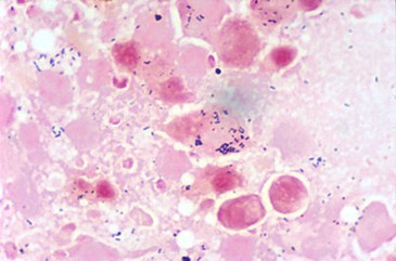 Renibacterium salmoninarum