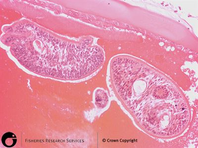 Diplostomum spathaceum metacercaria within the lens of rainbow trout