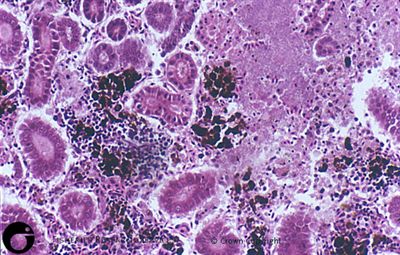 Necrosis within posterior kidney, x20, H&E stain