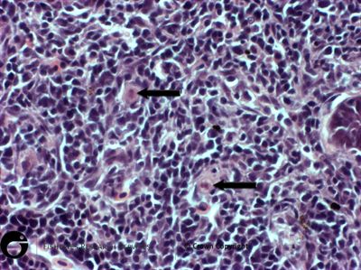 Natural infection of proliferative kidney disease in rainbow trout