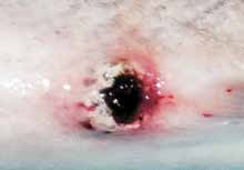 moderate red vent syndrome