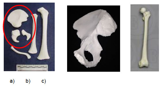 Image Five: a) Reference casts of bones from an infant aged 1-2 years, includes unfused bones of the right pelvis (encircled in red), humerus, femur (on right of picture) and clavicle; b) reference cast of adult right side of pelvis; fully formed and development completed; c) reference cast of adult femur, fully formed and development completed. Image Five: a) Reference casts of bones from an infant aged 1-2 years, includes unfused bones of the right pelvis (encircled in red), humerus, femur (on right of picture) and clavicle; b) reference cast of adult right side of pelvis; fully formed and development completed; c) reference cast of adult femur, fully formed and development completed.