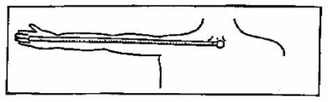 Figure 4 The Demispan Measurement