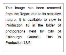 Image 6: Warriston, Full Term Stillbirth