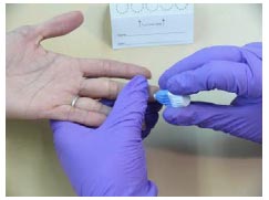 Remove the blue tip from the lancet in order to activate it. While holding the respondents hand firmly, place the lancet on the side of the pad of the respondent’s finger or thumb.