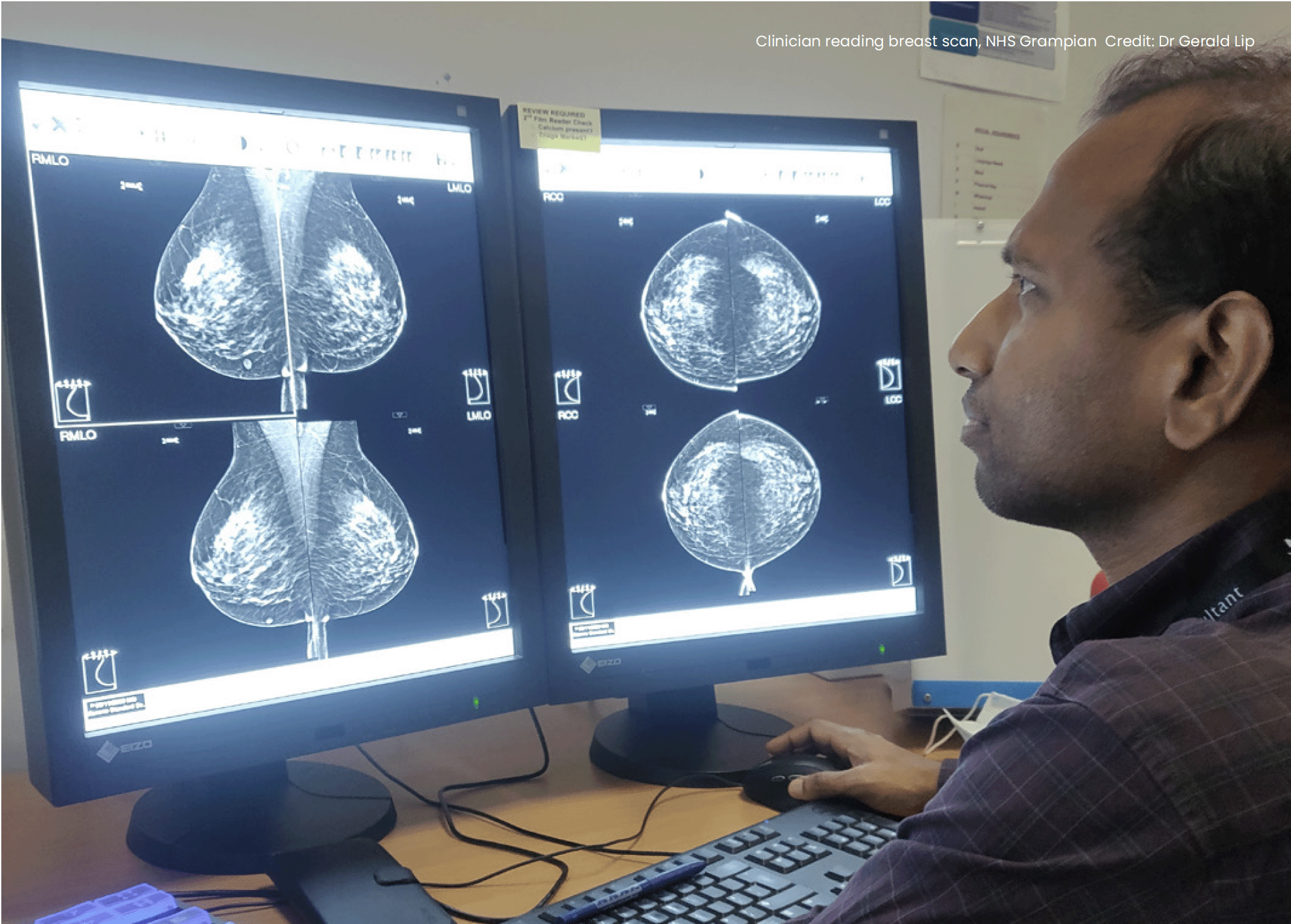 A photo of a clinician analysing a breast scan.